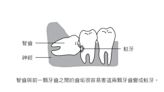 智齒長出來一點有需要拔嗎？牙醫揭「先照X光再說」：1情況不能留