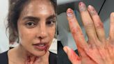 Priyanka Chopra Shares Clip Of Injured Hand But It Is For Her Upcoming Film The Bluff - News18