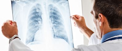 Amgen/AstraZeneca Say Asthma Drug Shows Activity In Another Lung Disease Across Broad Patient Population