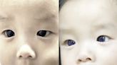 Thai baby's dark brown eyes turn indigo blue after COVID-19 treatment