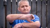 Man has double hand transplant in ‘world first’ for scleroderma patient