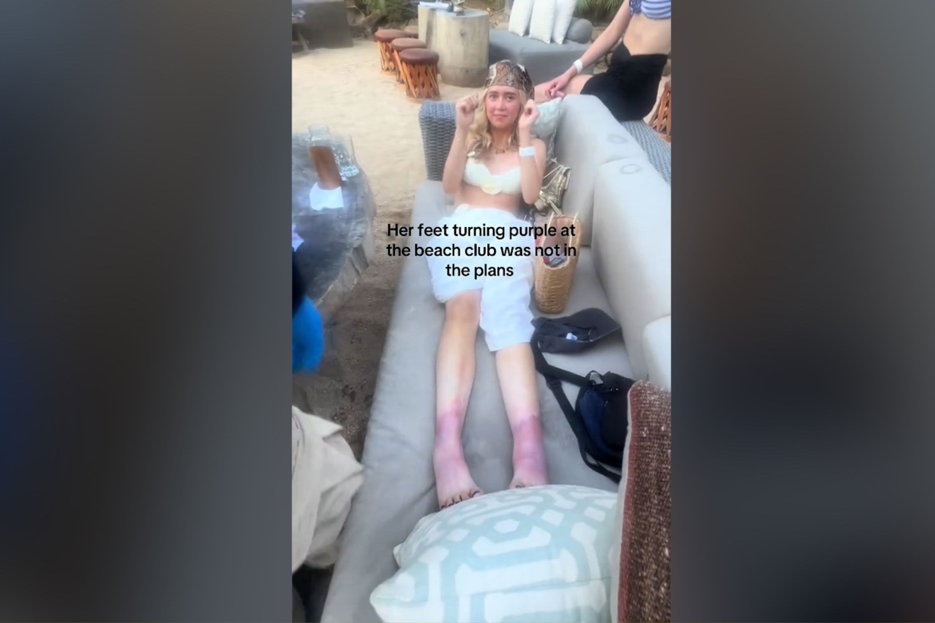 American woman's feet mysteriously turn purple on vacation in Mexico