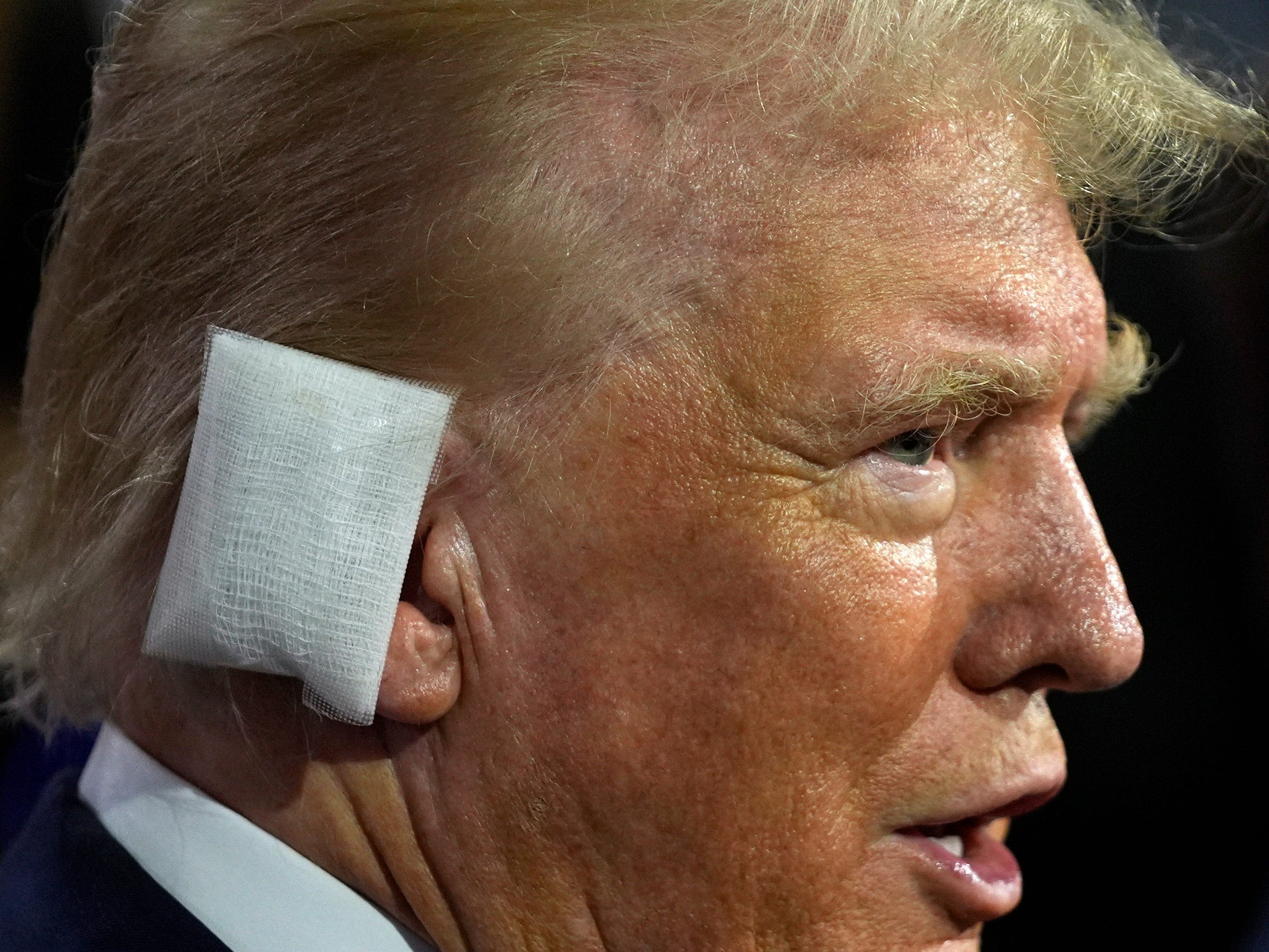 Trump is back out in the spotlight for the first time after his assassination attempt, and he's wearing a massive rectangular bandage over his ear