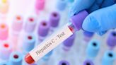 'I'm a Hepatologist, and This Is the #1 Most Important Question to Ask When You Get a Hepatitis C Diagnosis'