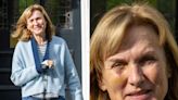 Fiona Bruce reveals full extent of black eye following horse riding accident
