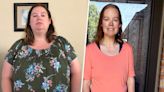 After losing 200 pounds, this mom is having 20 pounds of loose skin removed