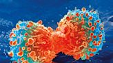 Ultrasensitive liquid biopsy tech spots cancer earlier than standard methods