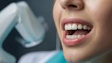 女子牙痛就醫 醫生檢查震驚：清出150隻蛆蟲 | 蕃新聞