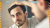 The Best Minoxidil Treatments for Men Stop Hair Loss and Promote New Hair Growth