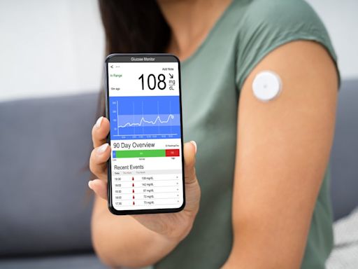 The future of continuous glucose monitors: global growth and US market leadership