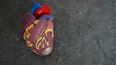 Cardiovascular deaths rose in first years of COVID, study says. Experts have ideas why
