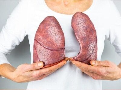 Most lung cancer patients in India are non-smokers, study reveals
