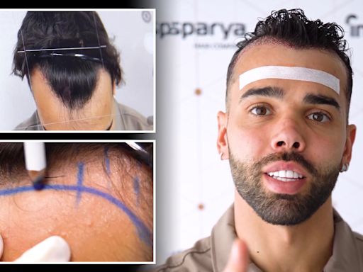 Arsenal star David Raya shows off new look after undergoing hair transplant