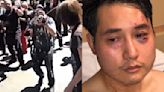Conservative journalist Andy Ngo wins $300,000 from 2019 milkshake attackers