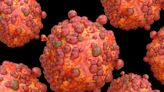 Monkeypox renamed as 'mpox' by WHO in effort to destigmatize the disease