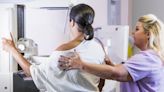 What All Women Need to Know About the New Mammogram Guidelines