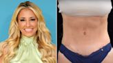 “RHONJ” Star Danielle Cabral Shows Off Tummy Tuck Results, Defends Earlier Comments About Ozempic Users
