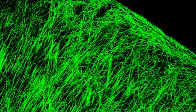 Small molecule shows early-stage promise for repairing myelin sheath damage