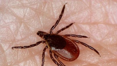 Researchers launching tick study after record year for Lyme disease