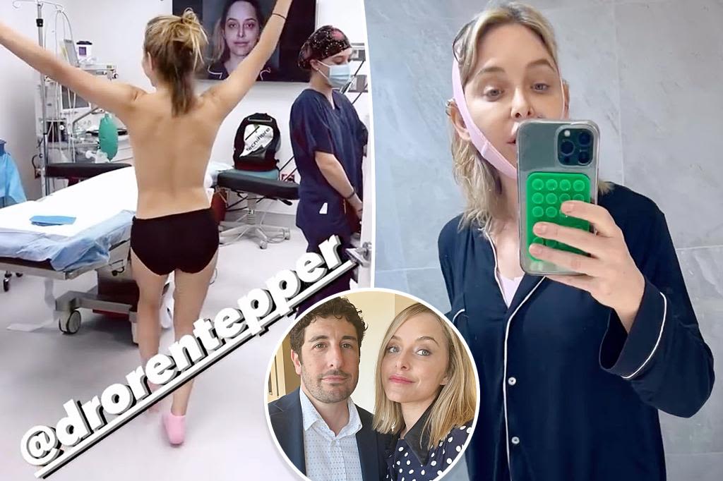 Jason Biggs’ wife, Jenny Mollen, reveals ‘Mother’s Day makeover’ after breast lift, fat transfer, chin lipo