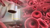 Patients Over 80 Still Benefit From Treatment for AML Blood Cancer