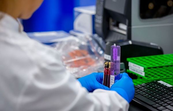 Blood test to detect colon cancer could move a step closer to FDA approval in the US