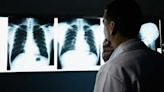 FDA Approves New Drug for Deadly Lung Cancer