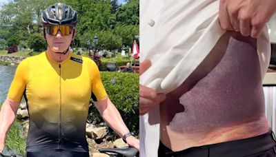 Gordon Ramsay Says He’s Lucky to Be Alive After Terrifying Bike Accident