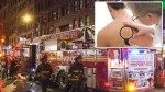 FDNY teams up with experts to offer free skin cancer screenings for firefighters