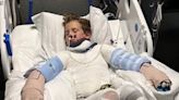 12-Year-Old Boy Suffers Severe Burns After Science Experiment Explodes: 'We Are Praying'