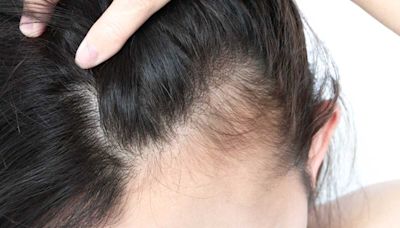Perte de cheveux : 3 coupes à éviter si vous avez les cheveux fins et clairsemés selon des coiffeurs