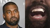 Cuántos miles de dólares gastó Kanye West en su nueva dentadura de titanio inspirada en un icónico personaje de cine