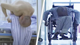 'Folded man' finally gets surgery to stand up straight after 28 years of suffering from rare disease