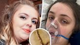 Young mum left fighting for her life in coma after botched surgery in Turkey