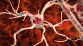FDA grants IND clearance for Spinogenix’s ALS treatment trial