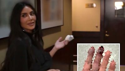 Kim Kardashian Shares Grisly Photos After Breaking Two Fingers -- Here's What Happened!