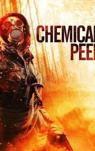 Chemical Peel