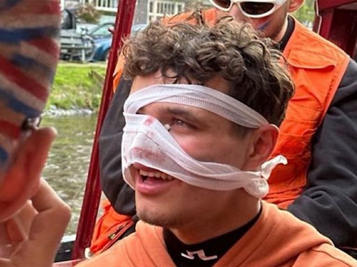 Lando Norris suffers nasty facial injury while partying in Amsterdam before Miami Grand Prix