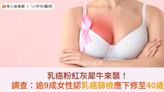 乳癌粉紅灰犀牛來襲！調查：逾9成女性認乳癌篩檢應下修至40歲