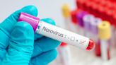 Norovirus outbreak 2024: How to avoid stomach bug spreading across northeast, NY