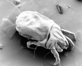 Dust mite allergy