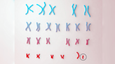 What’s Happening With The Y Chromosome?