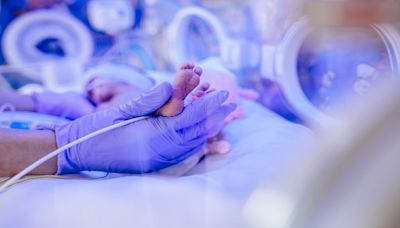 AngelEye Health acquires EDNA portfolio to enhance neonatal care