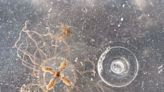 Toxic clinging jellyfish with ‘excruciating’ sting spotted near Jersey Shore