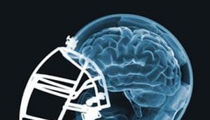 Return to activity, limiting screen time good after concussions, new study says