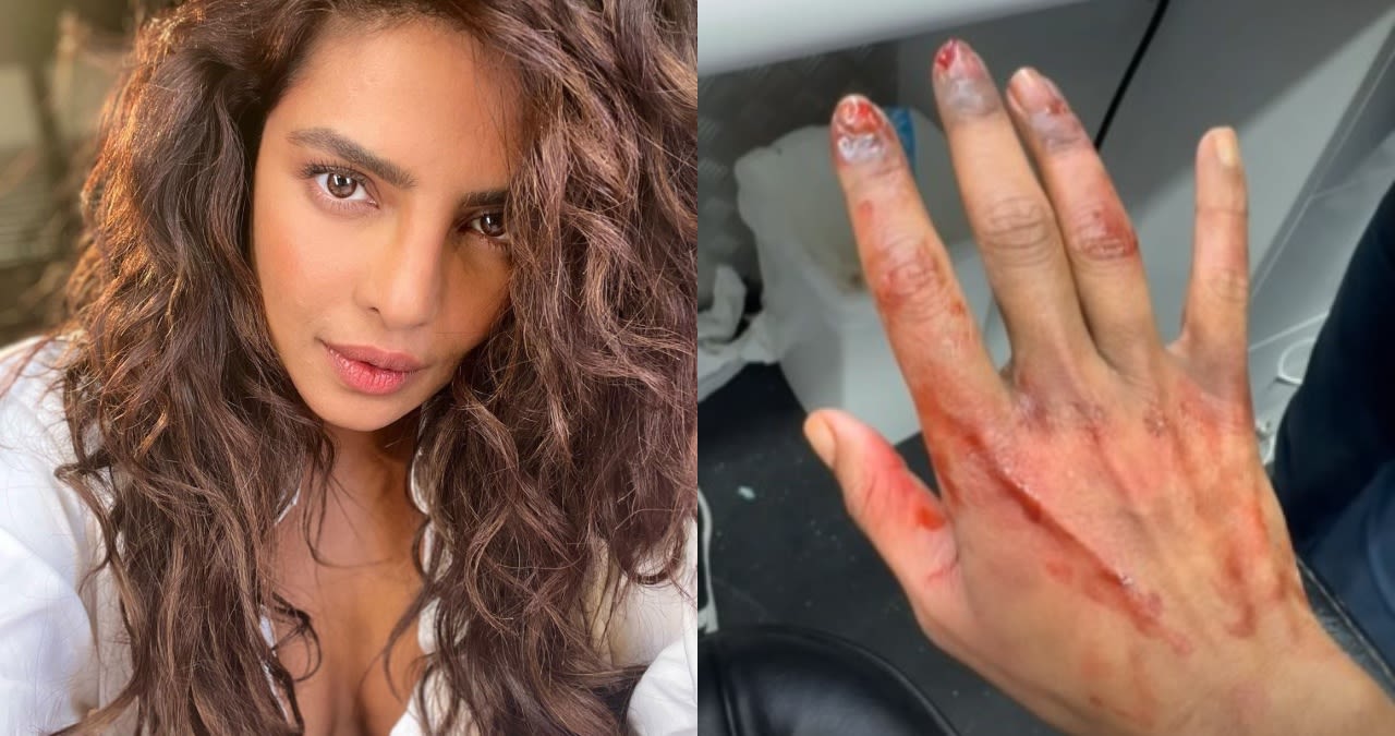 'The Bluff': Priyanka Chopra shows off her injured hand in new video but it's not what you think