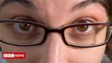 Ioga ocular: exercitar os olhos pode impedir ou atrasar o uso de óculos?