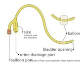 Foley catheter