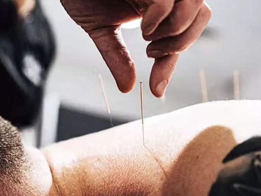 Govt considering recommendation to set up regulatory mechanism on acupuncture - ET HealthWorld