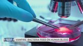 Concern over ‘Vampire Bacteria’ — and more